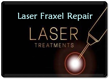 tratament laser cicatrici- 3