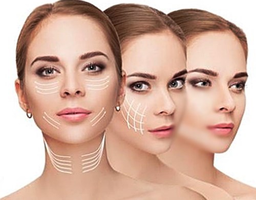 lifting facial pret